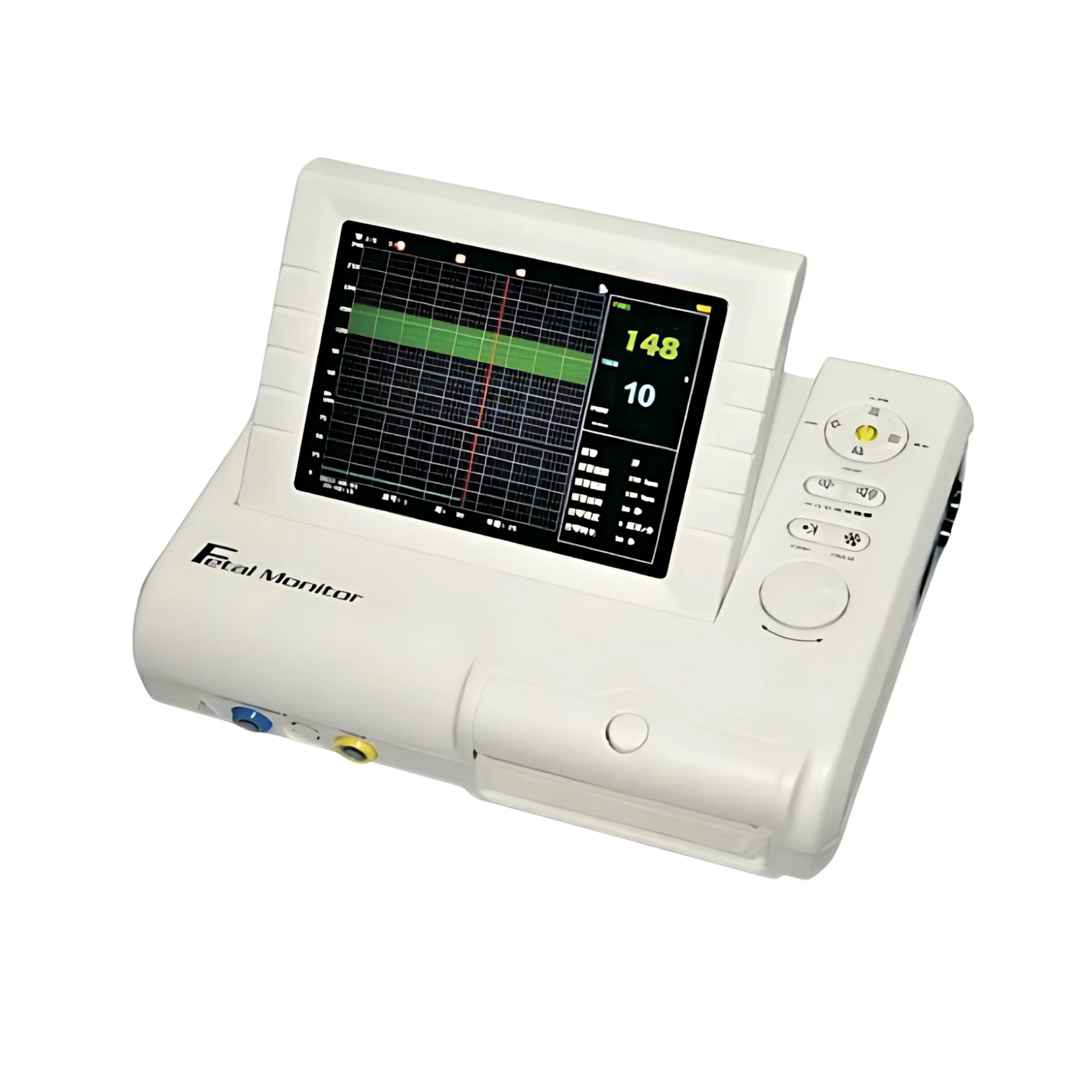 Fetal Monitor